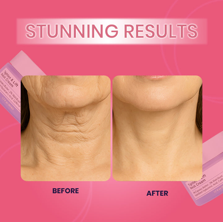 Tighten and Lift Neck Cream